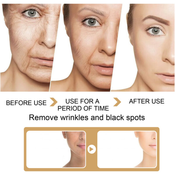 EELHOE Turmeric Dark Spot Correction Face Care Spot Moisturizing And Repairing Skin Tone Serum - Image 3