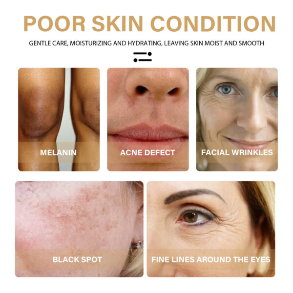 EELHOE Turmeric Dark Spot Correction Face Care Spot Moisturizing And Repairing Skin Tone Serum - Image 6